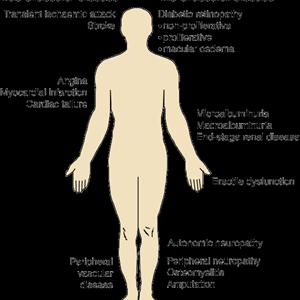  Diabetes: The Result Of An Unhealthy Lifestyle